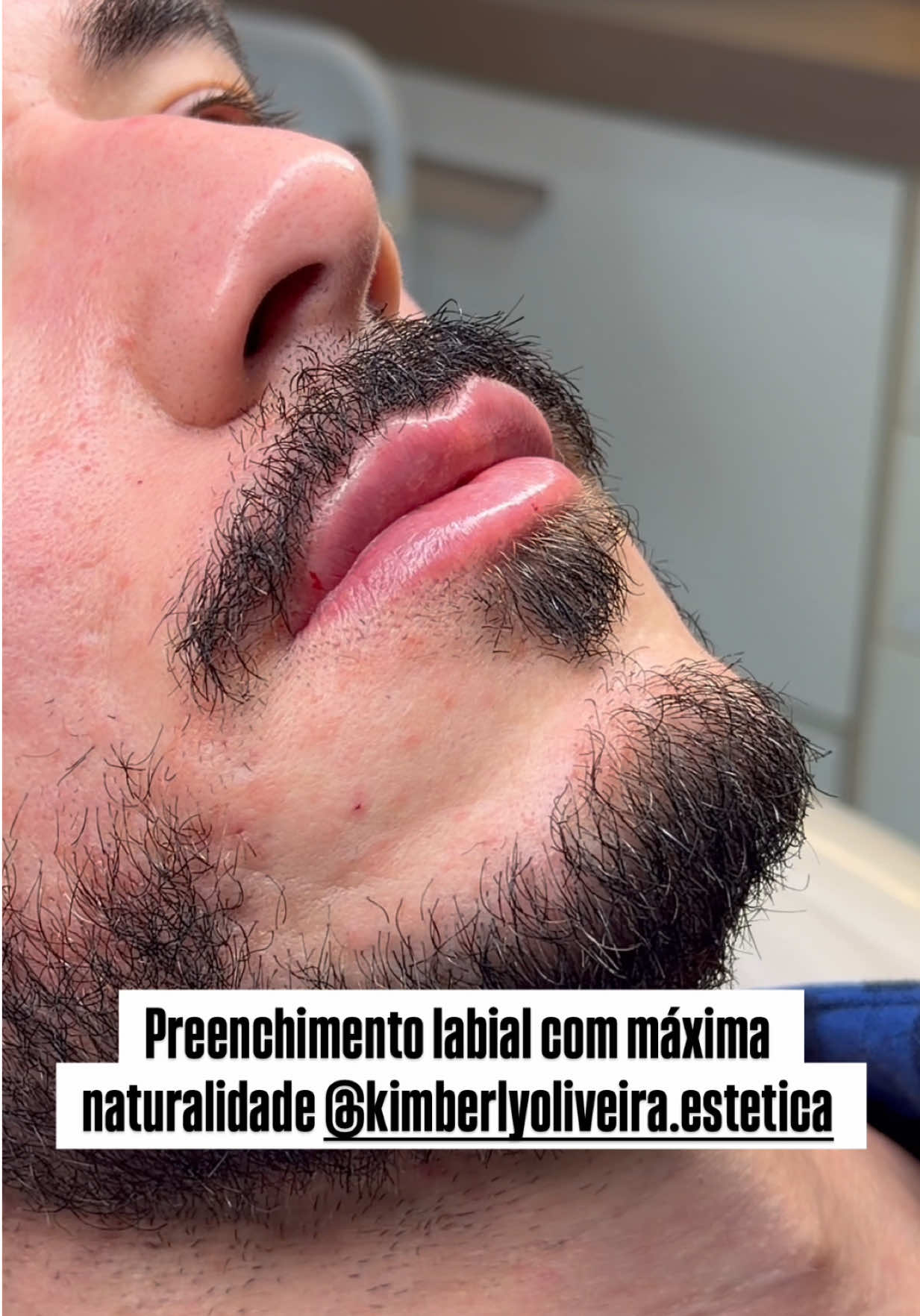 @Mateus Bandeira