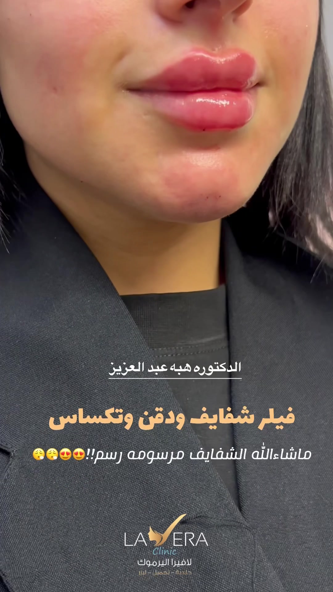 @عيادات لافيرا حي اليرموك