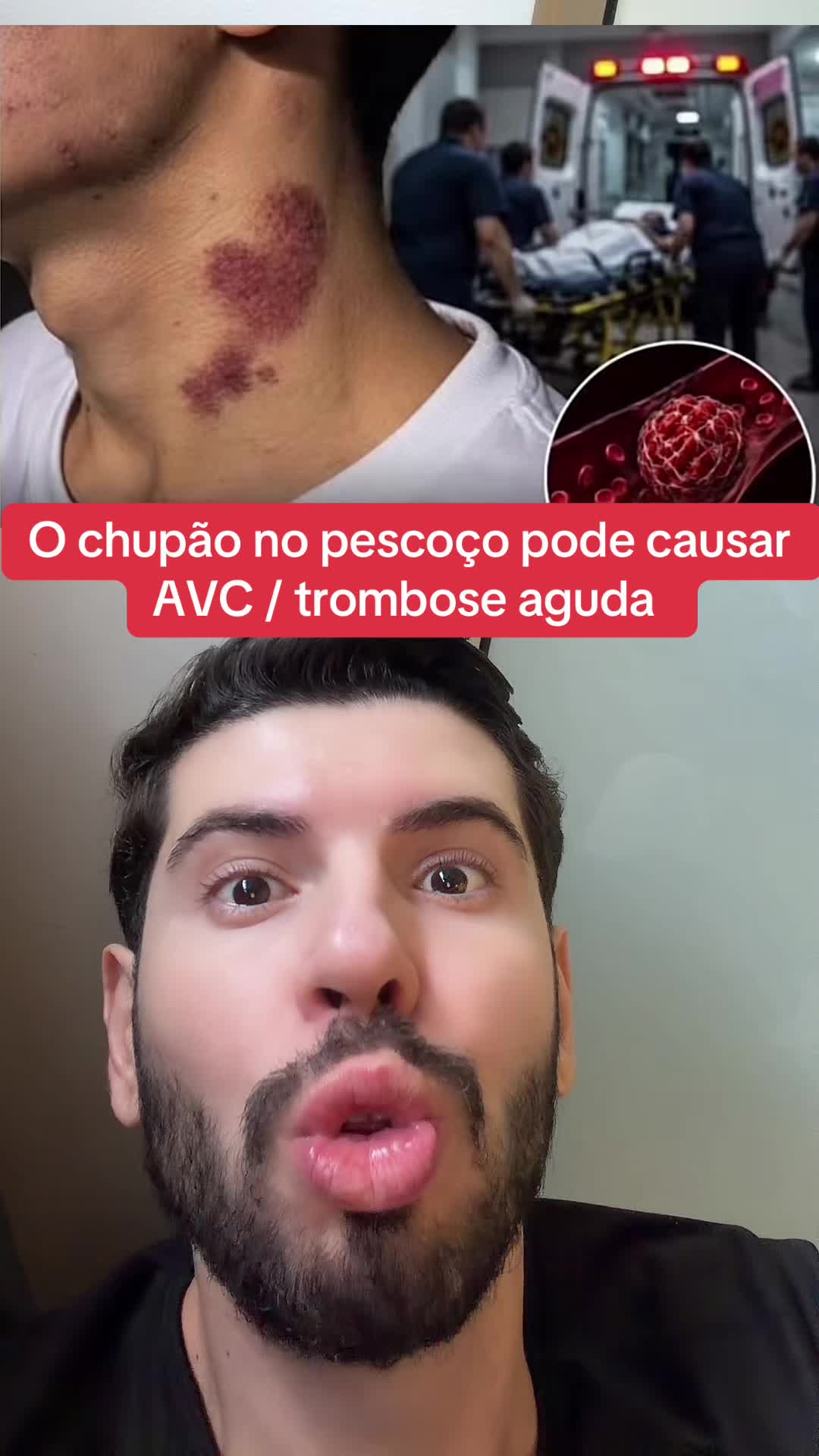 @Giamzito