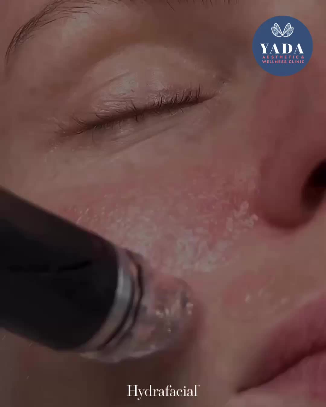 @Yada Clinic Pattaya