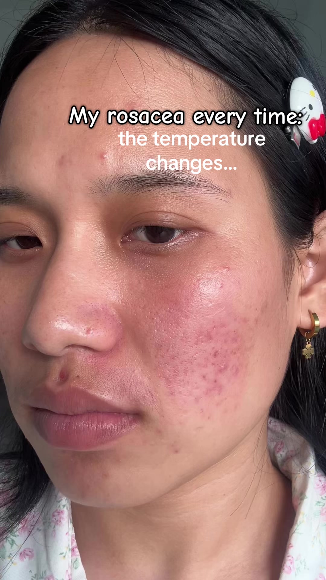 @Styleandskinbysanju