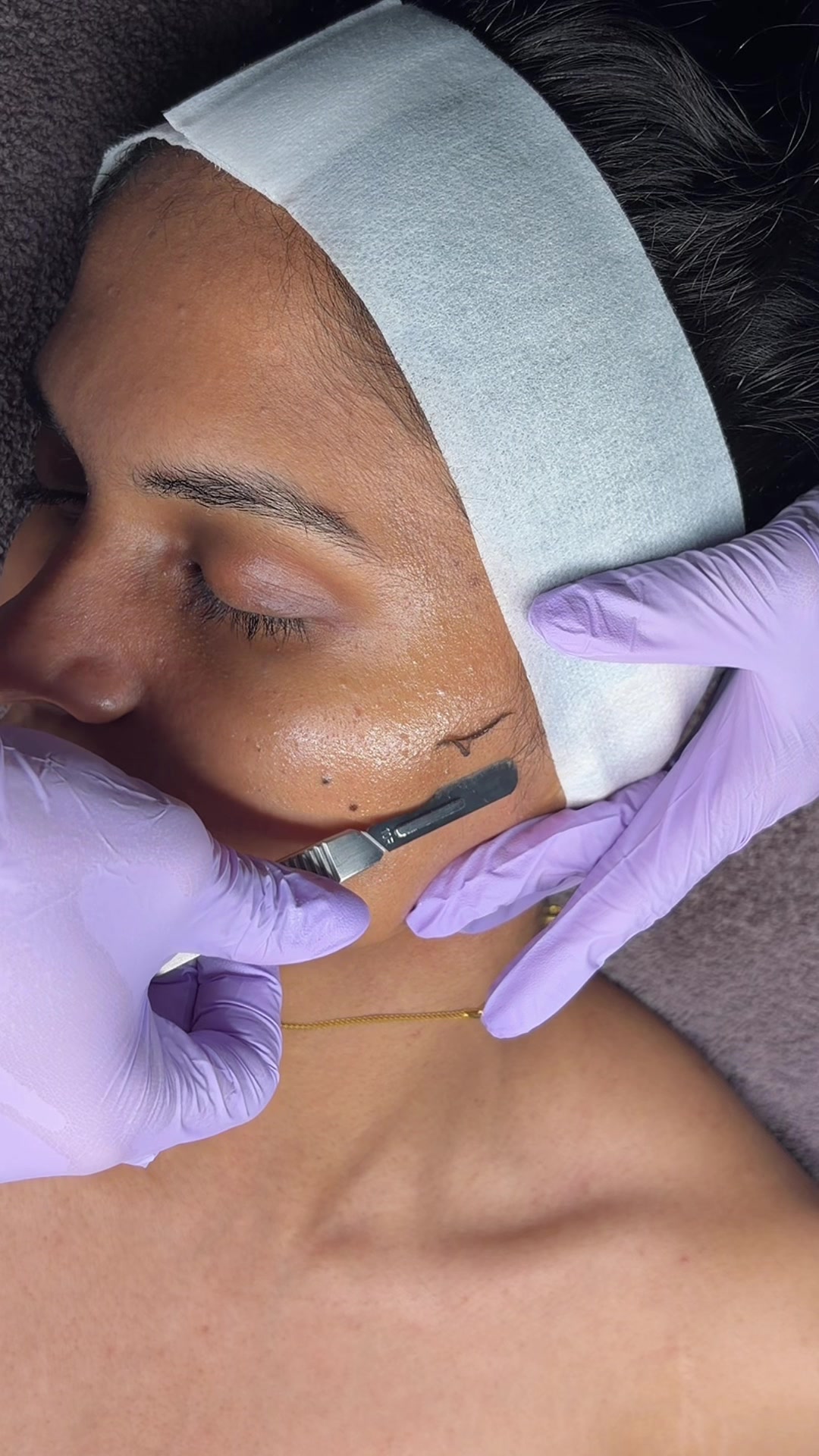 @Toronto Facialist