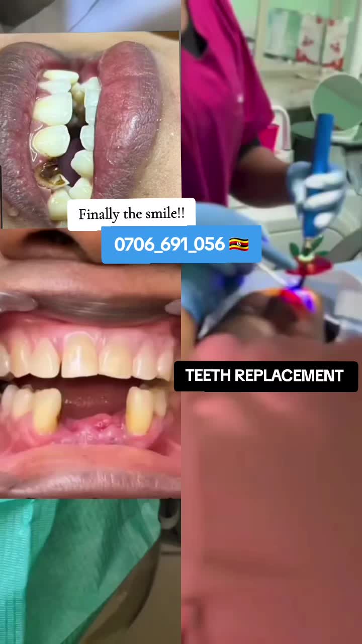 @Dental studio.🦷.Kampala