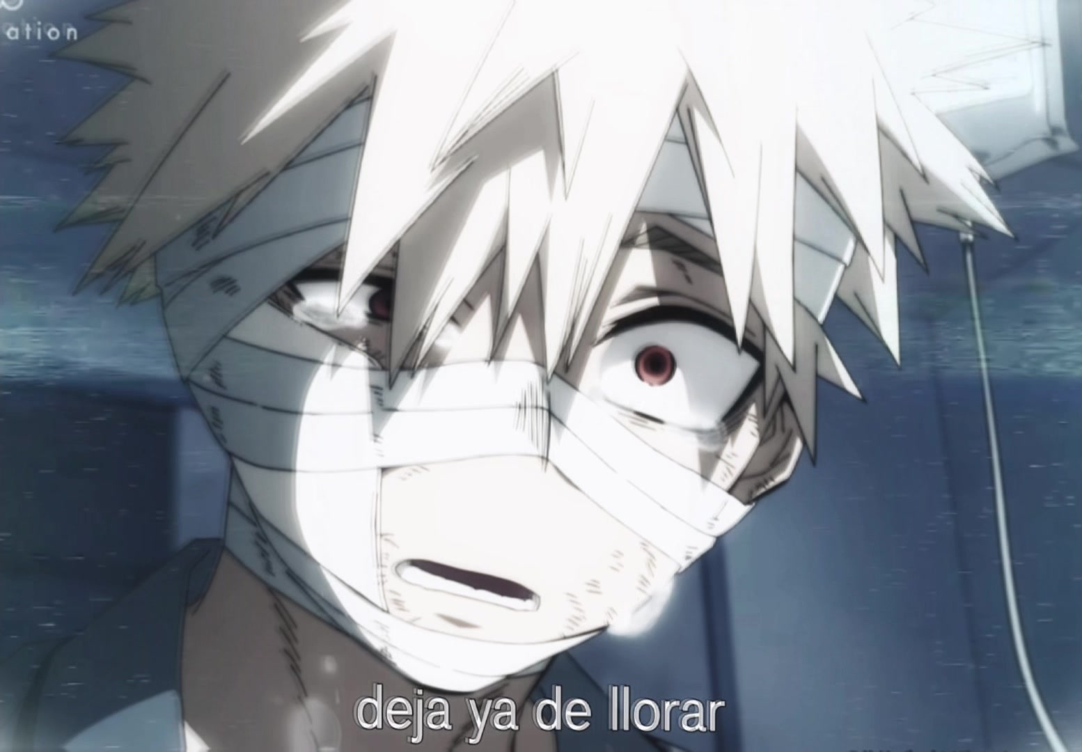 @izuku&rsquo;s curled toenail (matsu)