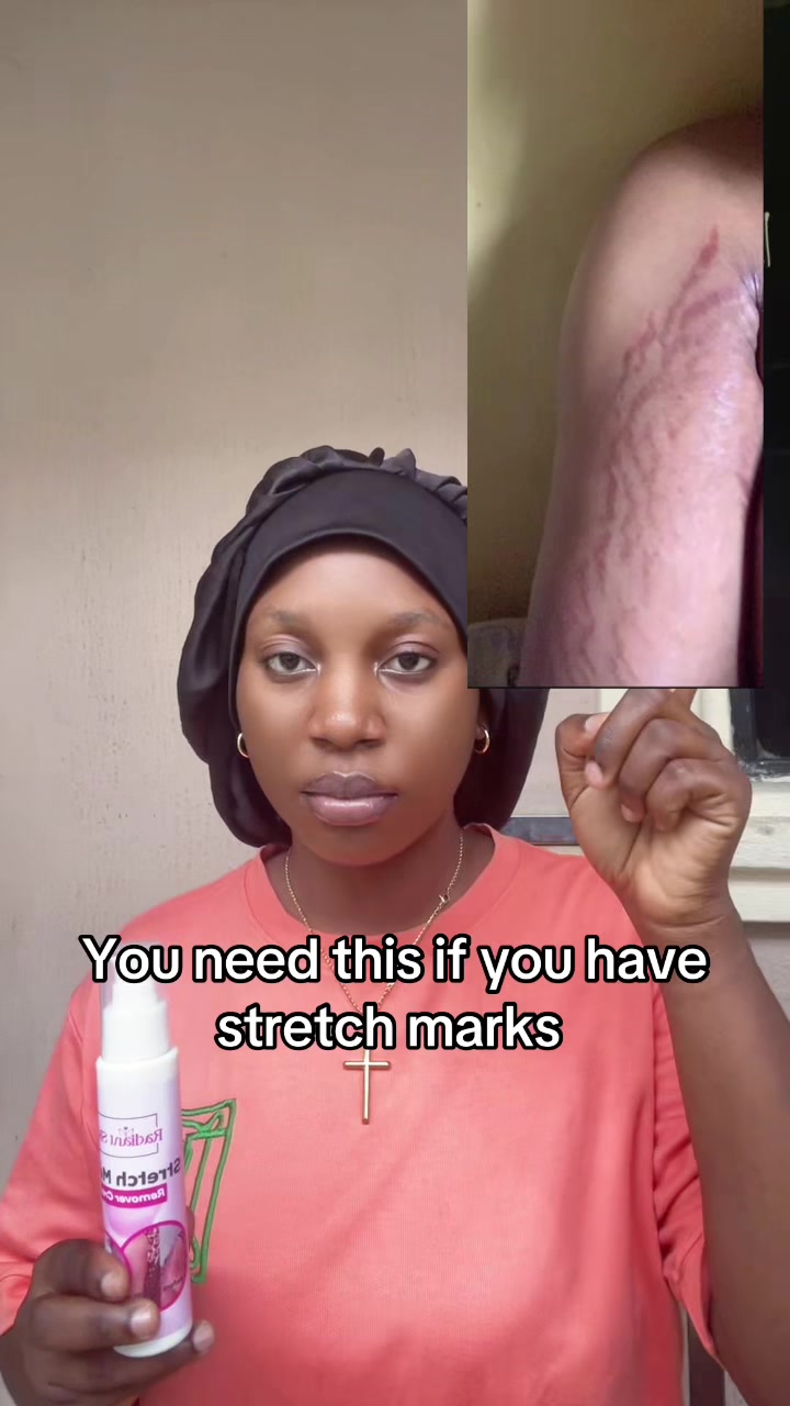 @Radiant skin