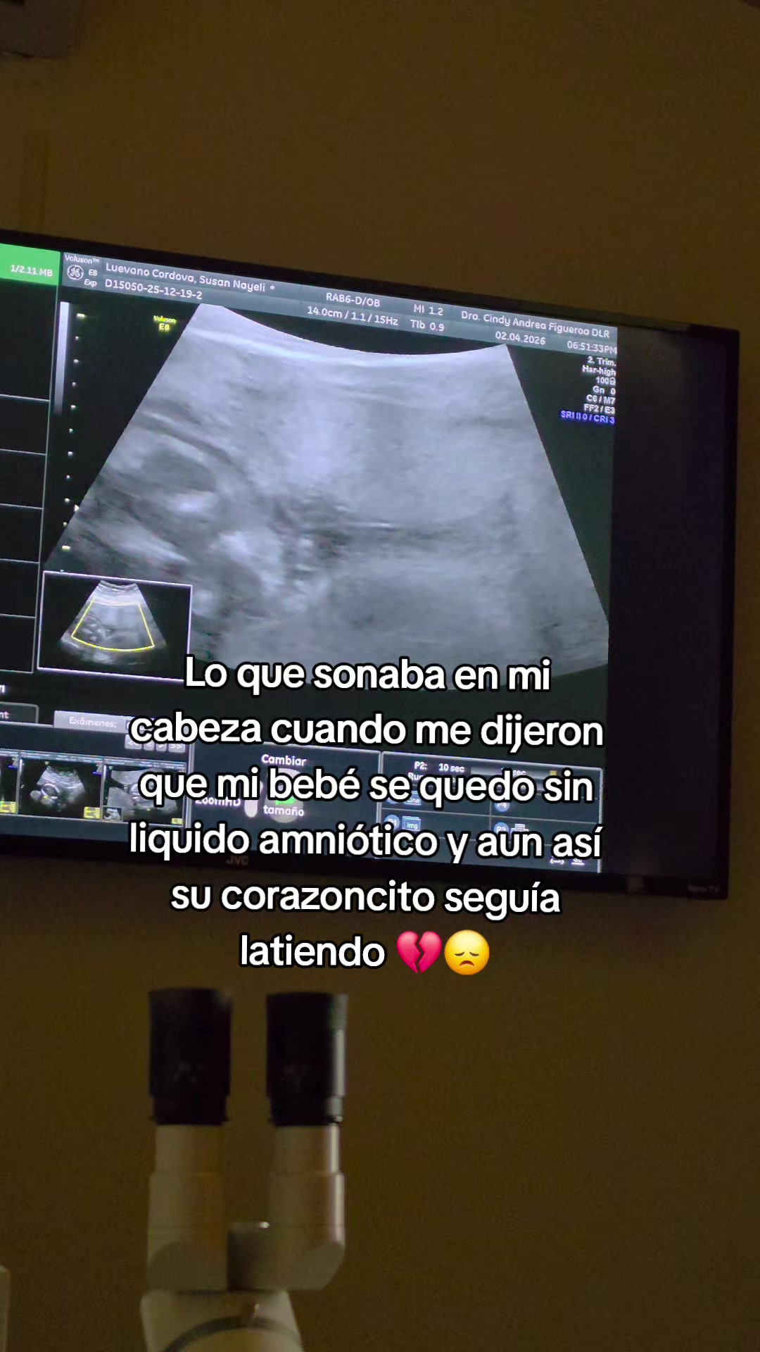 @Naye Córdova 🥀