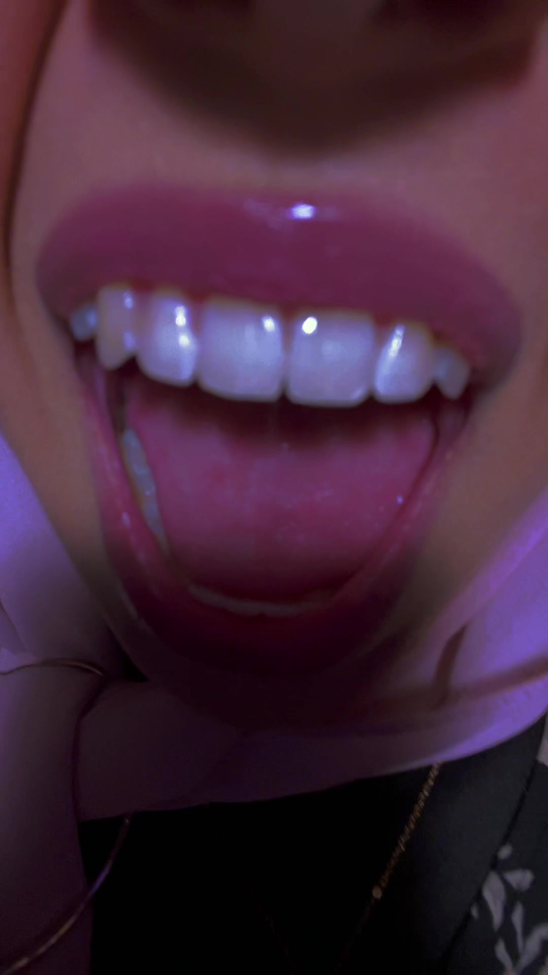 @💕⁷