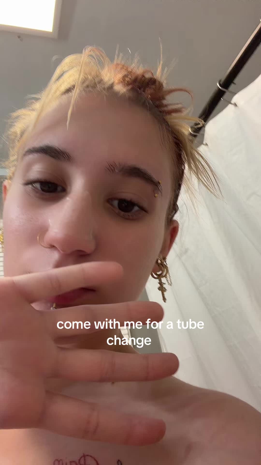 @🪱