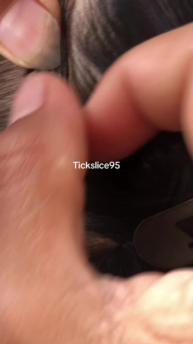 @Tickslice95