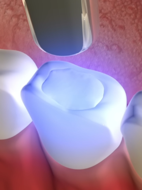 @Tech Dental