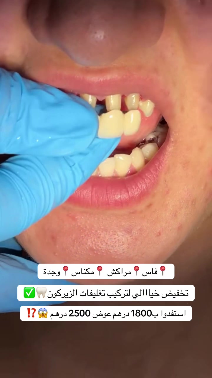 @brightsmileee1