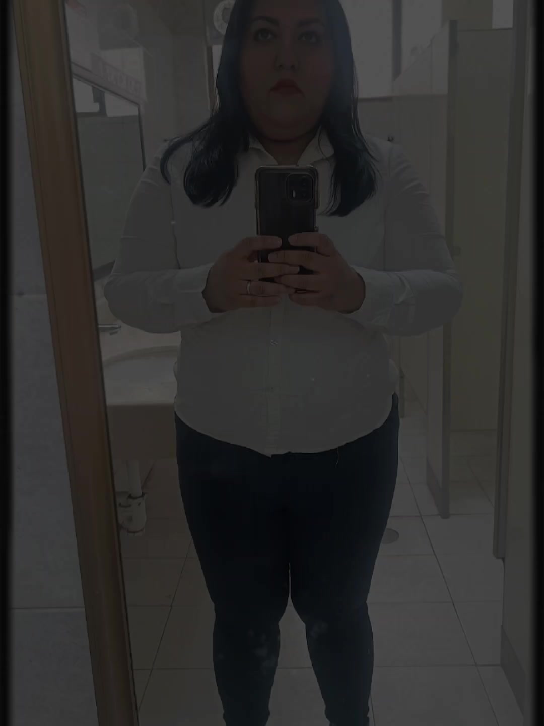 @Lupitta Orozco Bariatric