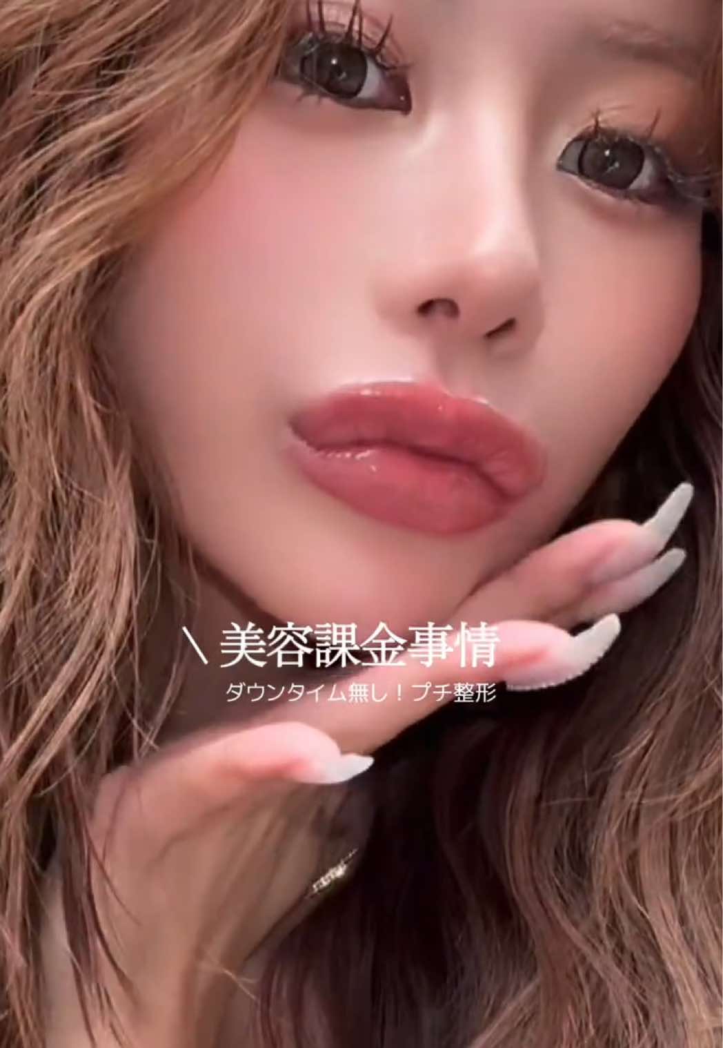 @瀬戸 南
