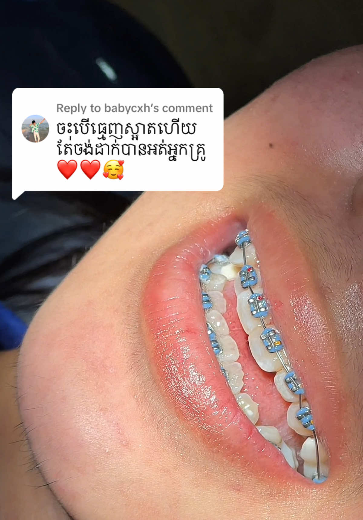 @BRIGHT SMILE DENTAL HOSPITAL