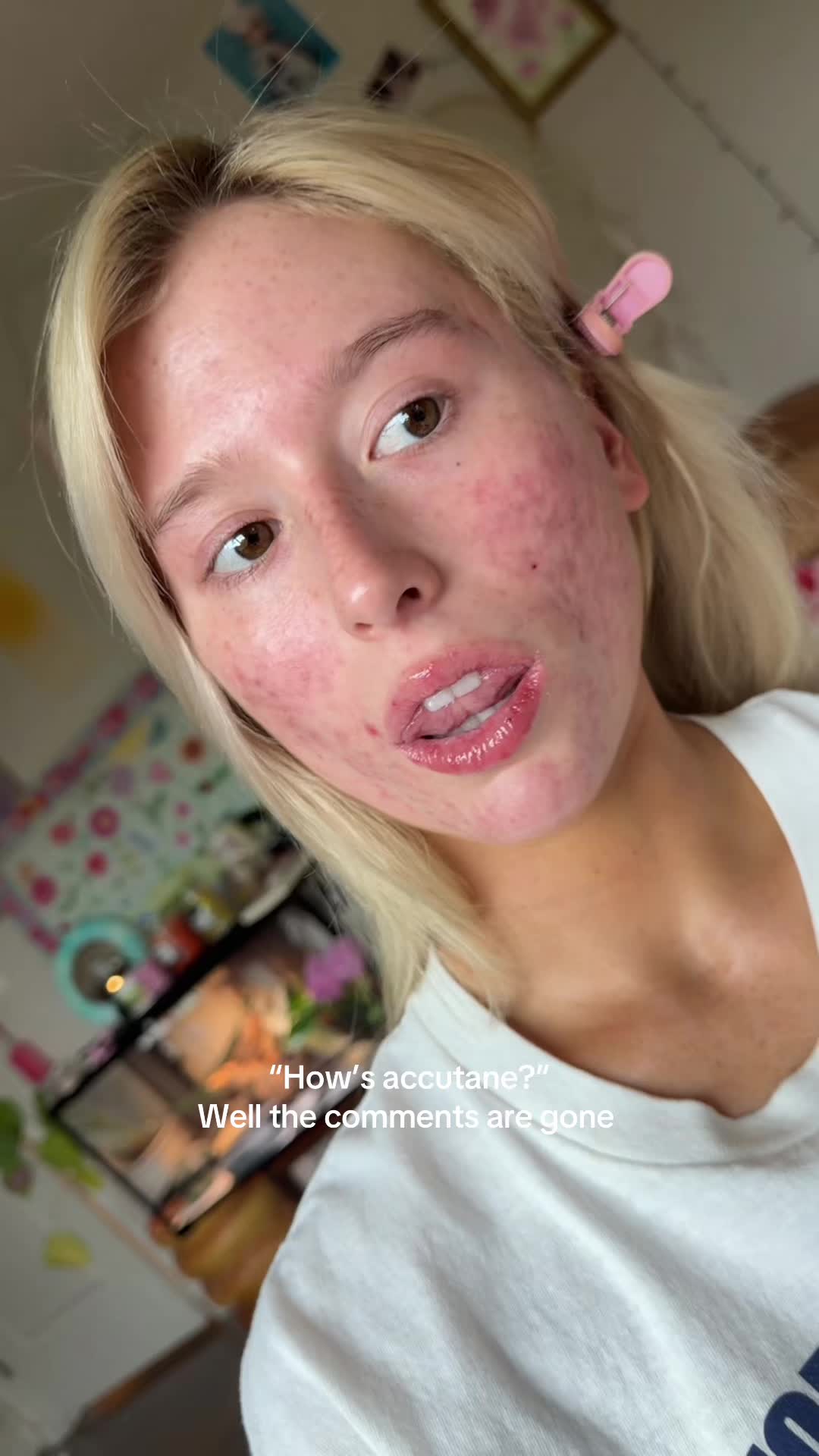@Secret