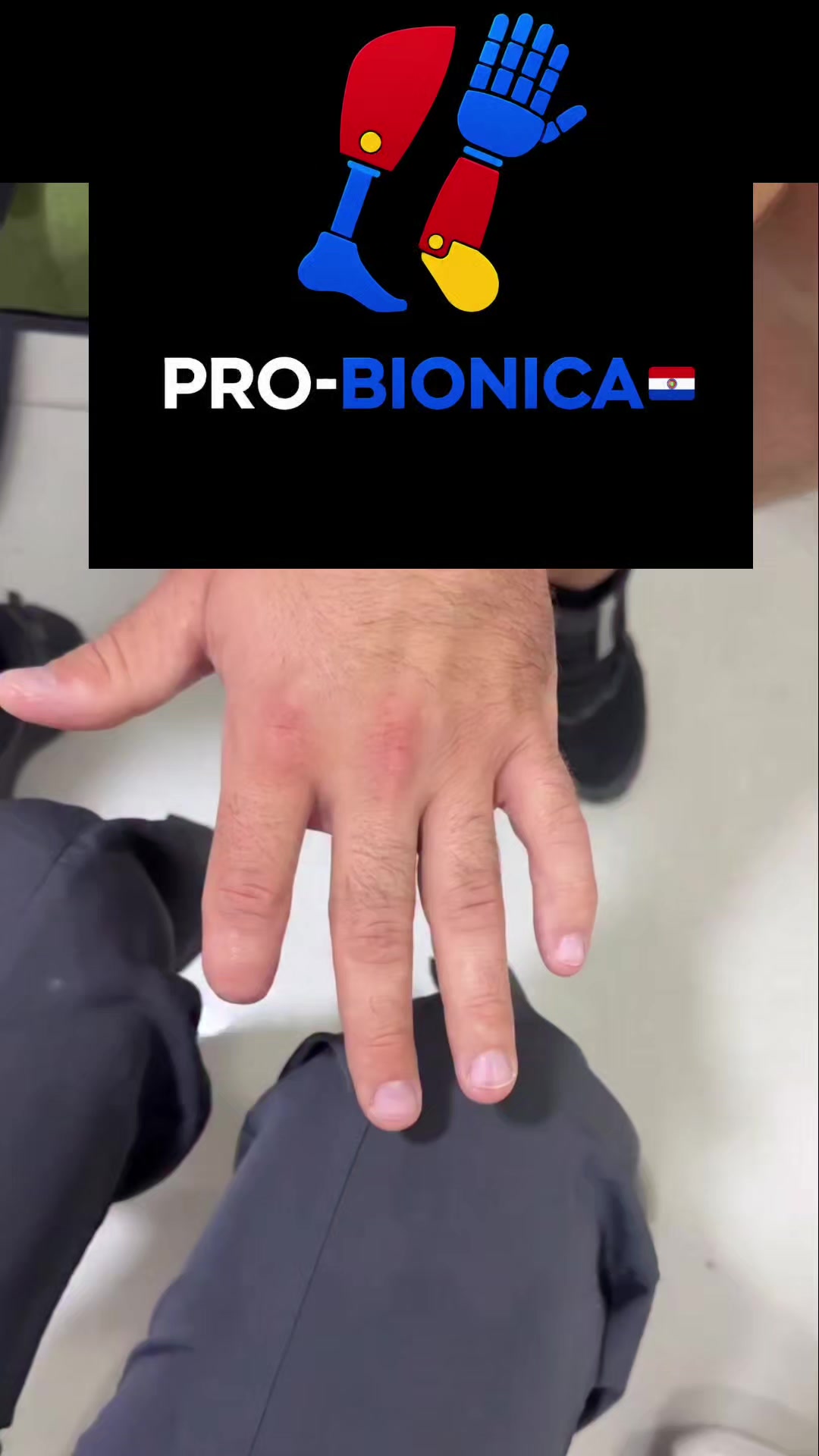 @Pro-Bionica Paraguay 🦿🦾