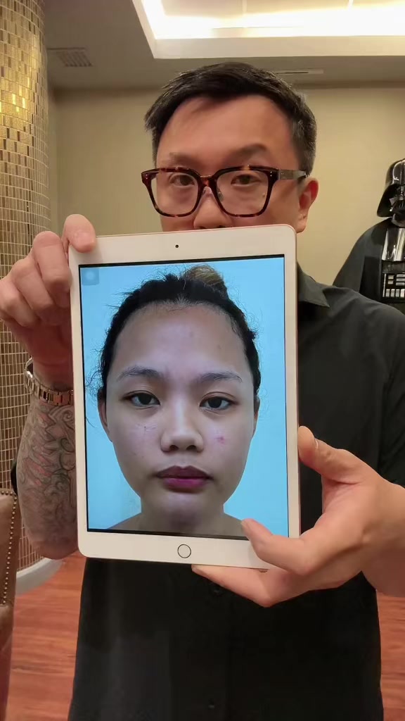 @Eric Yapjuangco, MD
