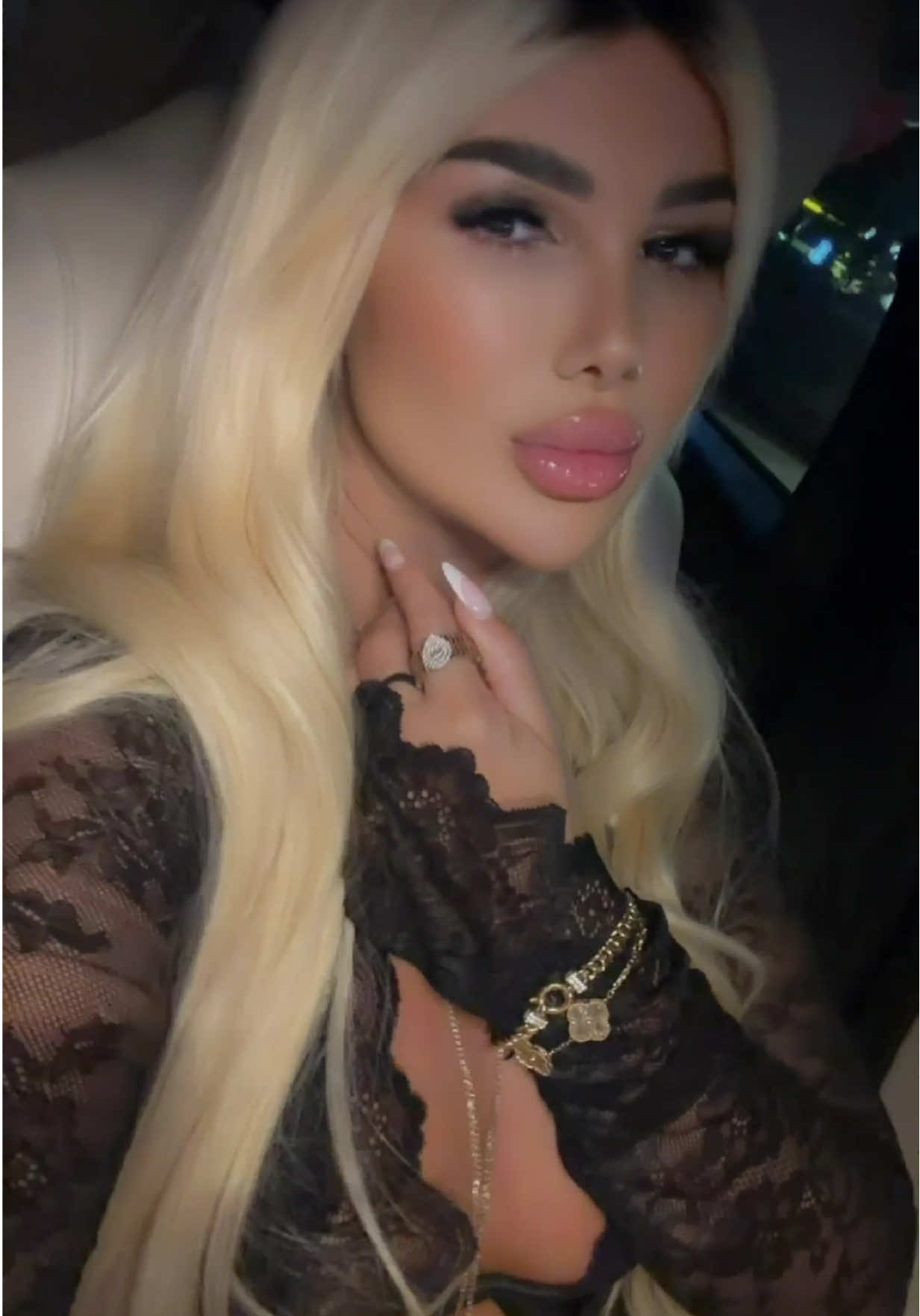 @Arbesa Mehmedaliu