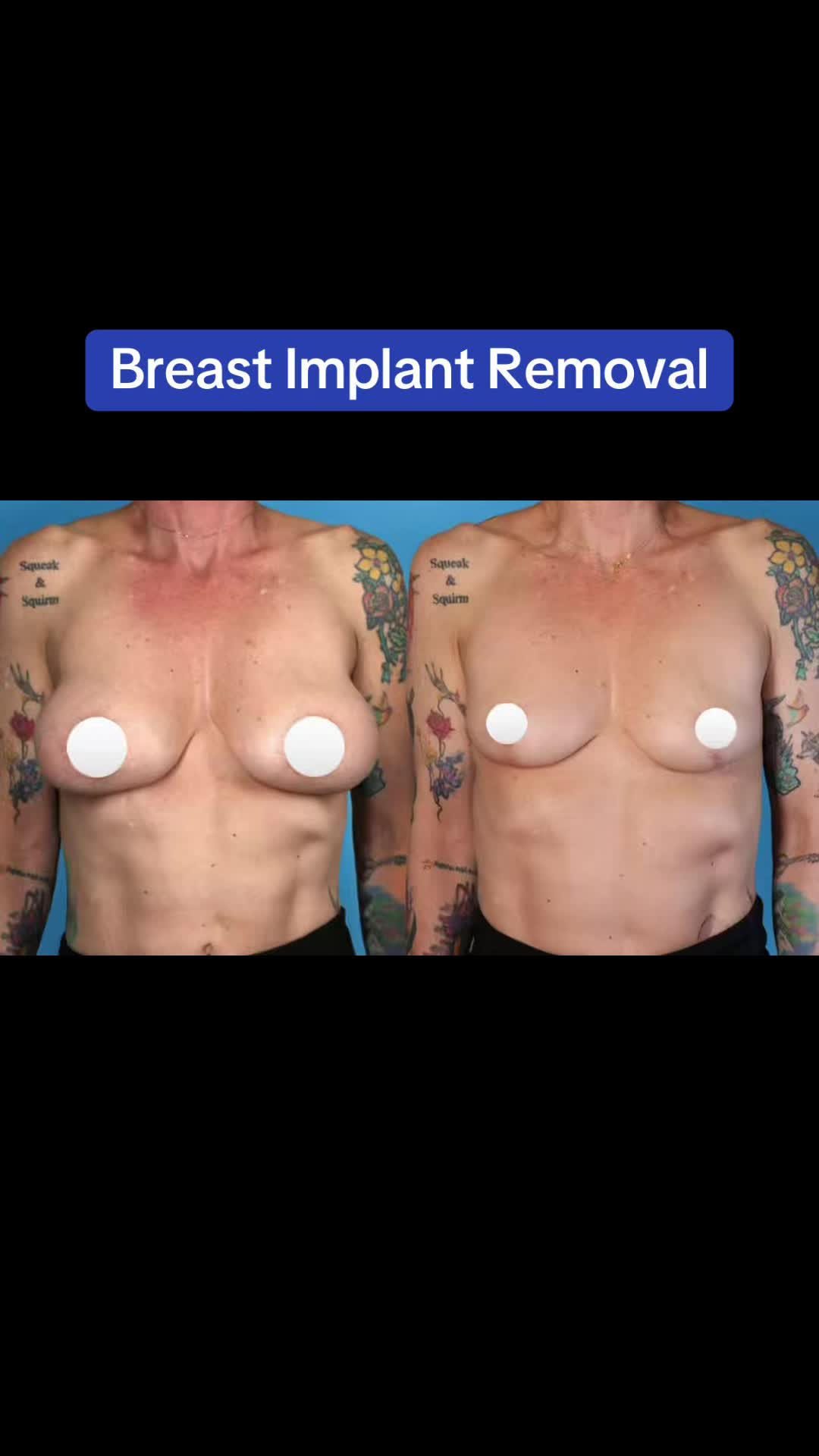 @Kelly&ensp;Killeen,&ensp;MD,&ensp;FACS