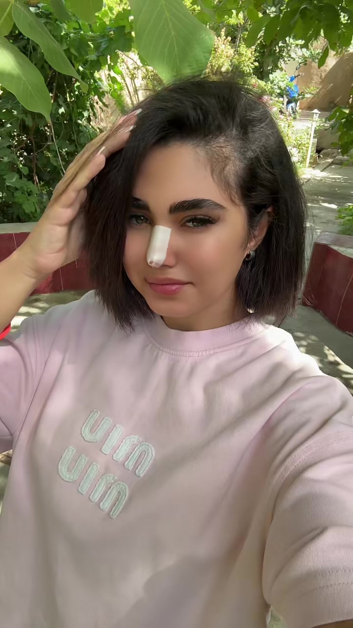 @MLA🍓