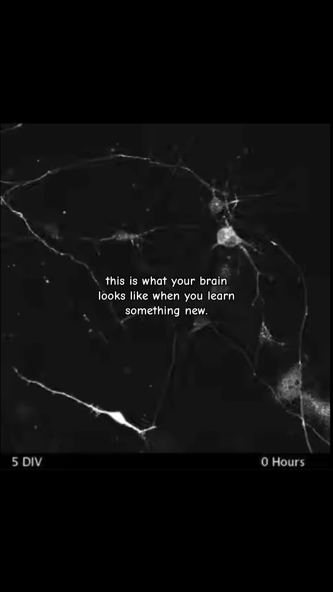 @Brainstormed