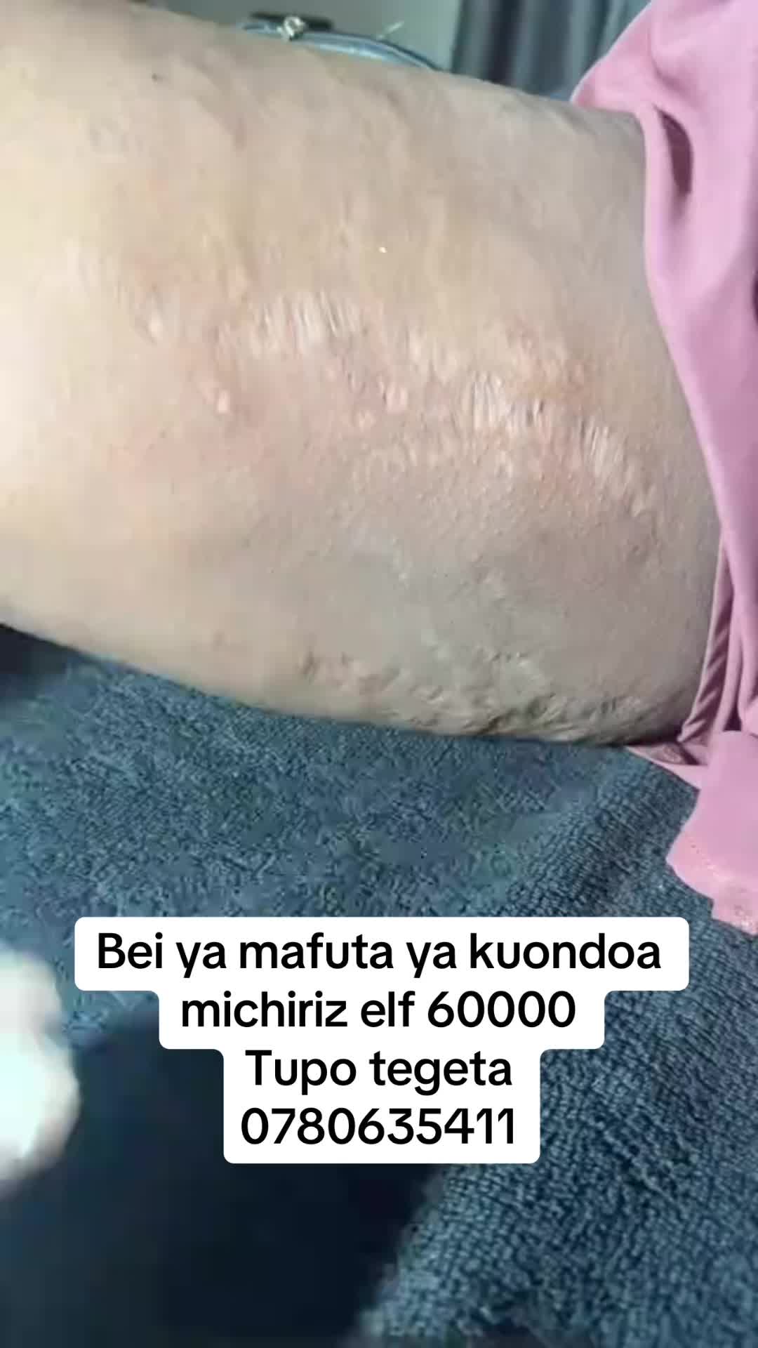 @๐๐๐๐๐๐๐๐๐๐๐๐๐๐๐