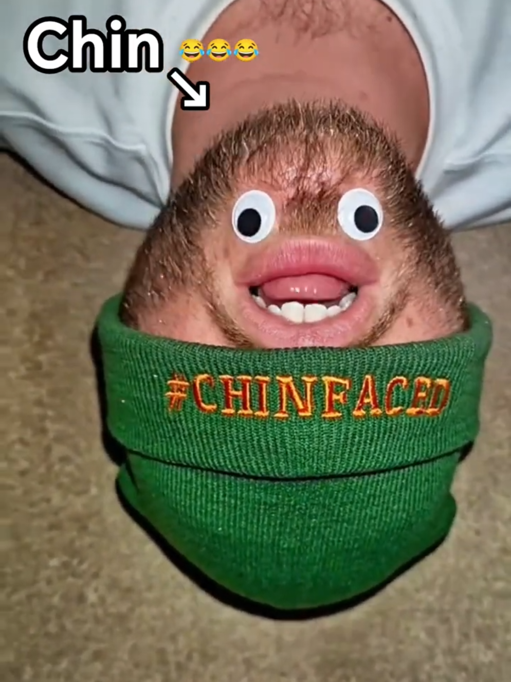 @Chinfaced