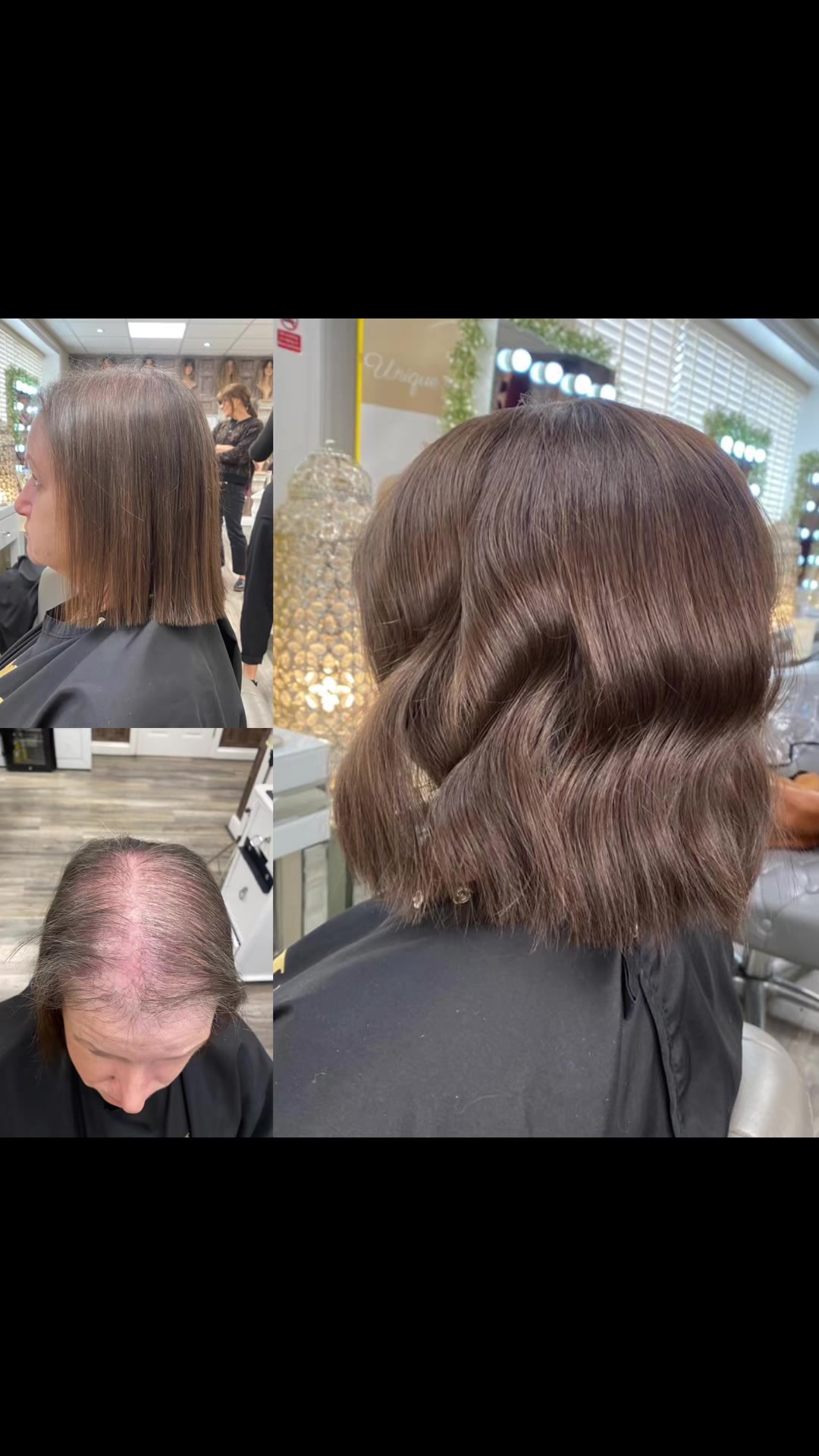 @Godiva Hair Loss Specialists