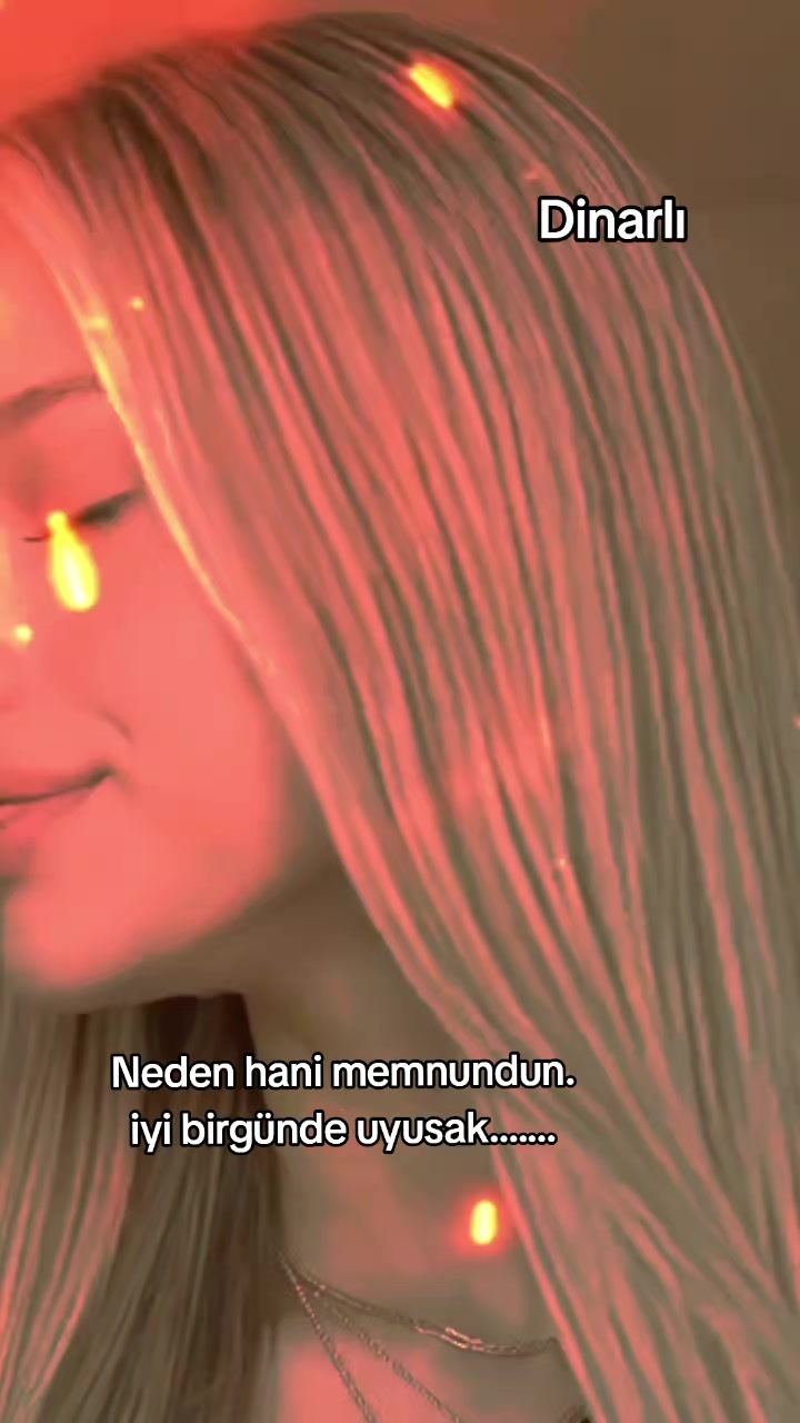 @BİR~ÖPSEN~BENİ~DİNARLI