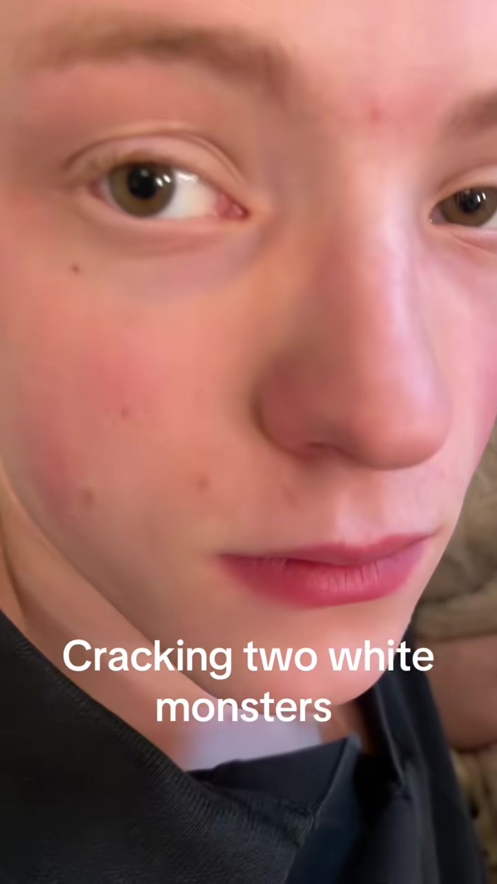@Saga