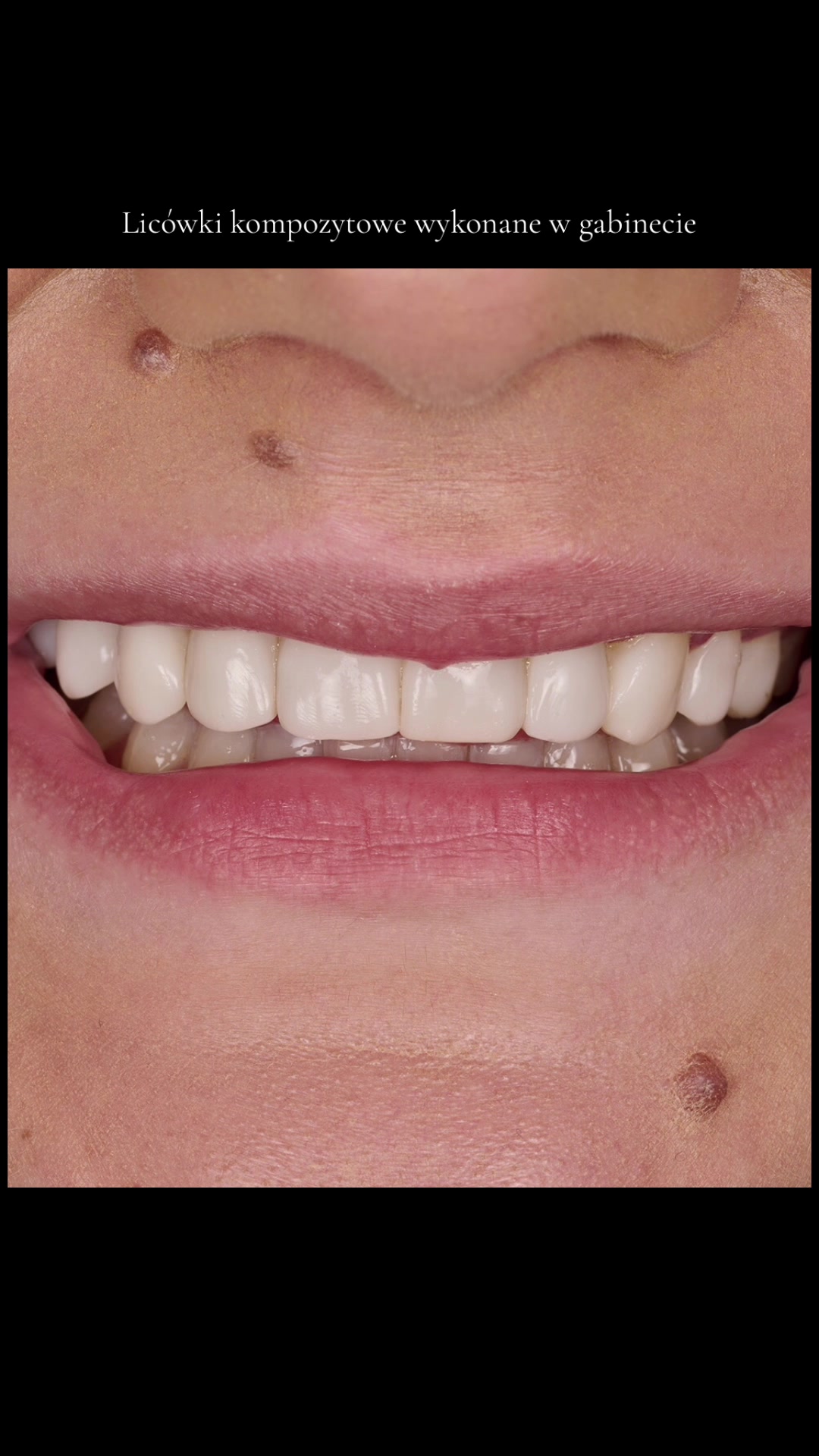 @Anna 🦷 dentystka