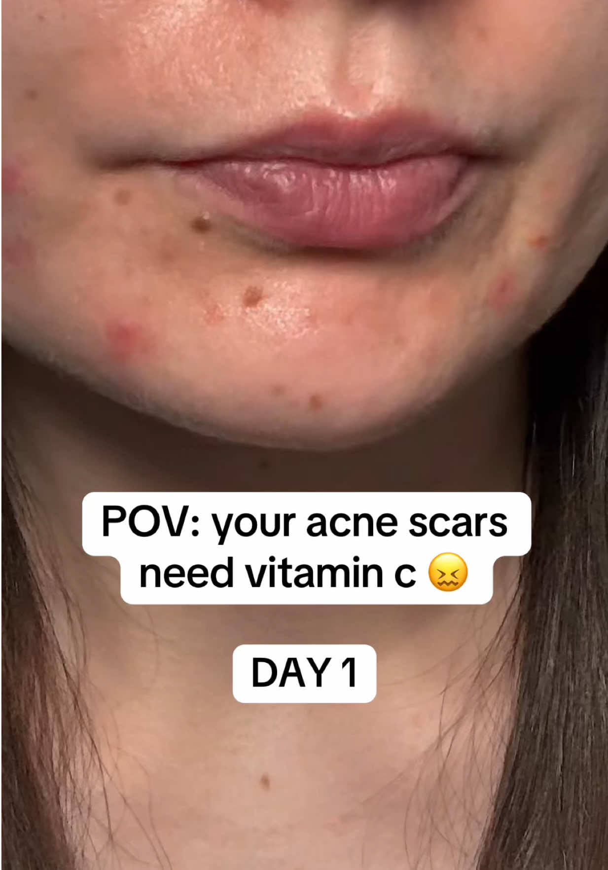 @watermelonsugarskin