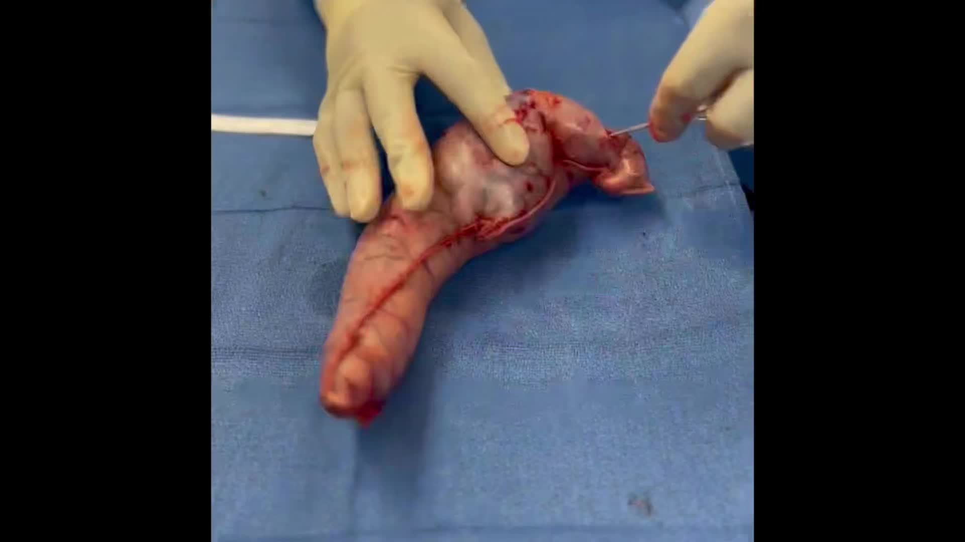 @The surgeon