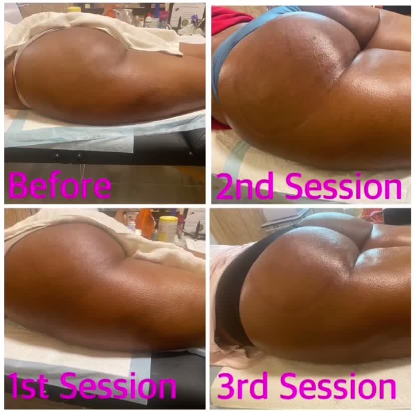 @NeeNee