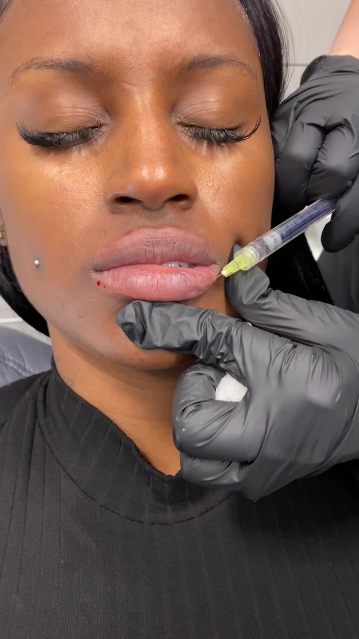 @Vanessa Injects