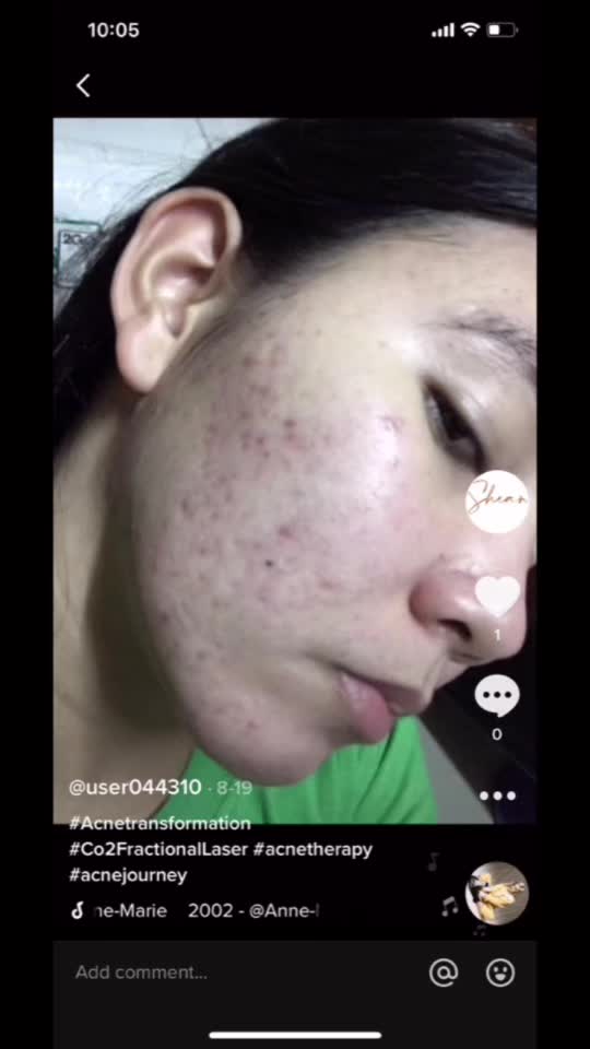 @user044310
