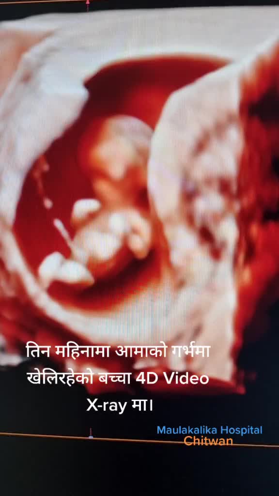 @Dr. Ramesh Ghimire