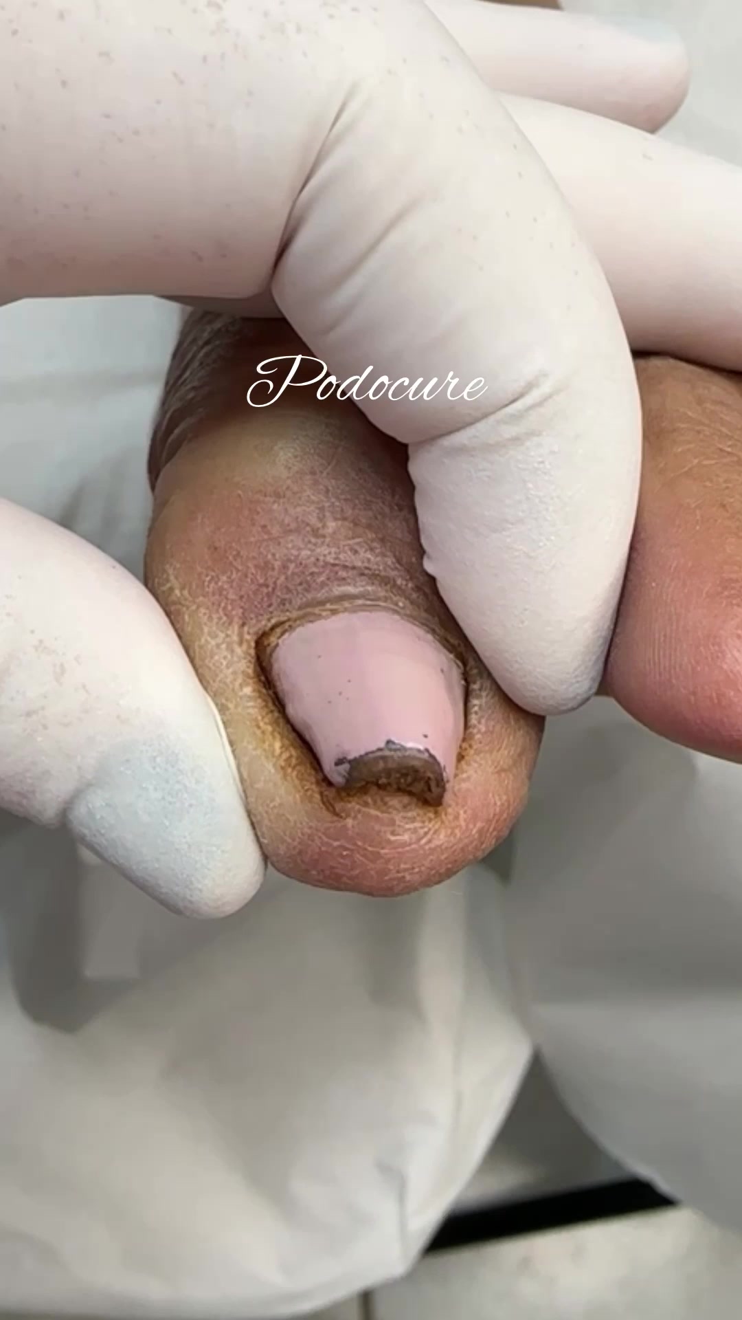 @Podocurebr
