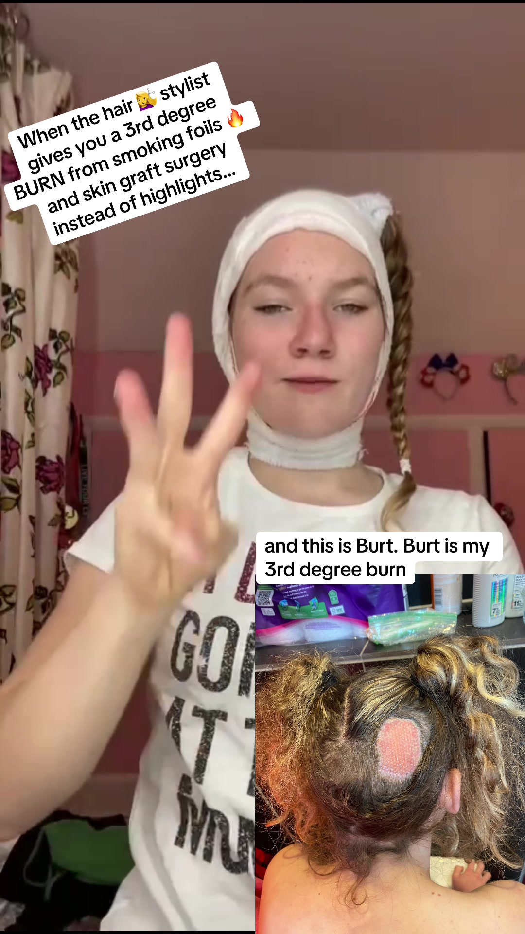 @coco❤️&zwj;🩹and💇&zwj;♀️burt.the.burn