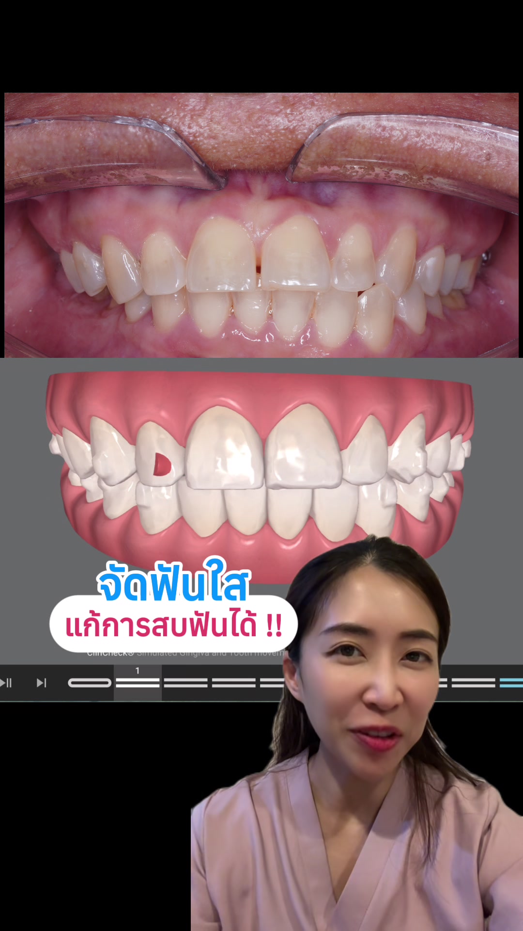 @ณัฐคุณ (Nuttakul Dent) 🦷
