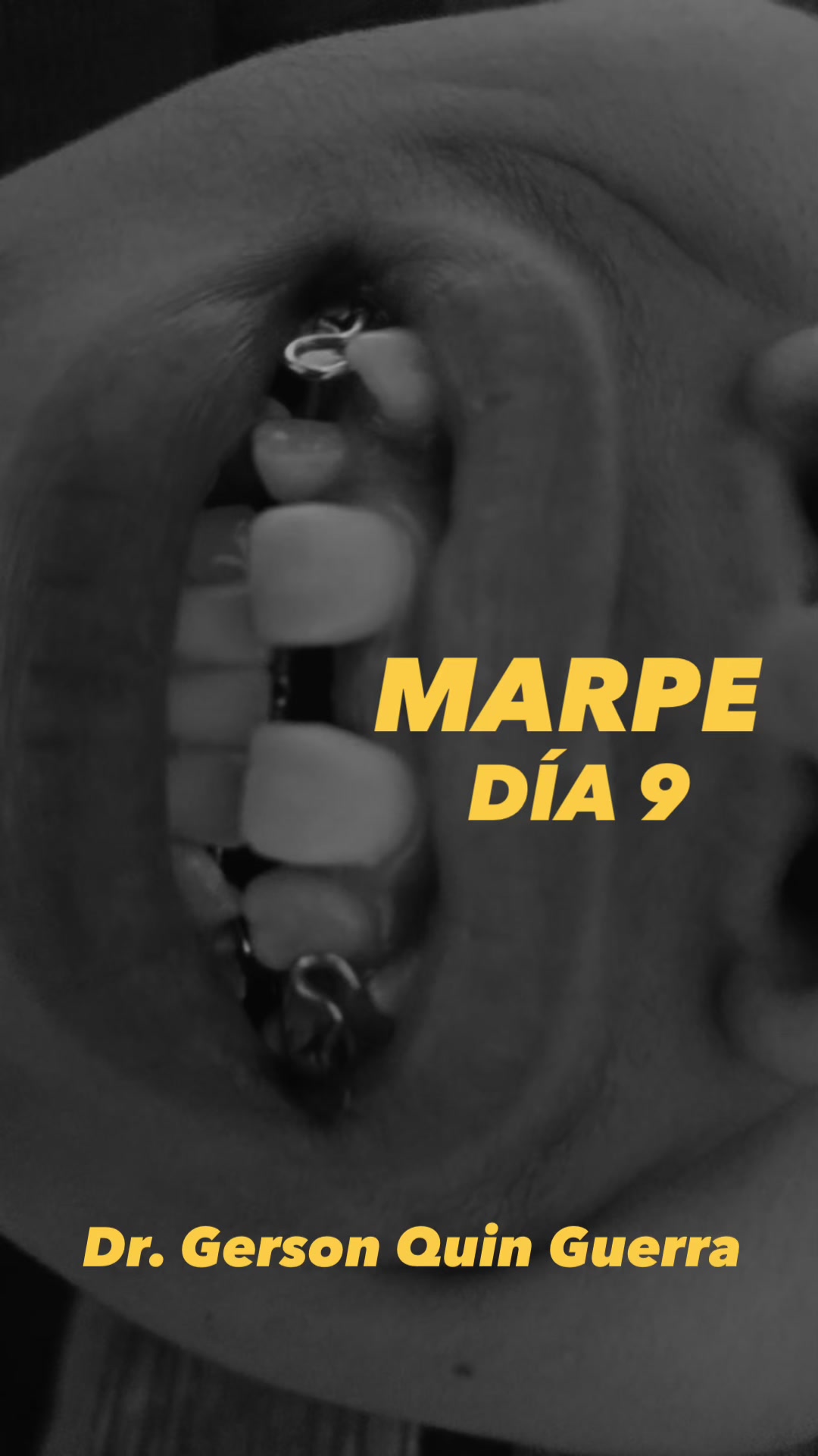 @Dr. Gerson Quin Guerra, PhD
