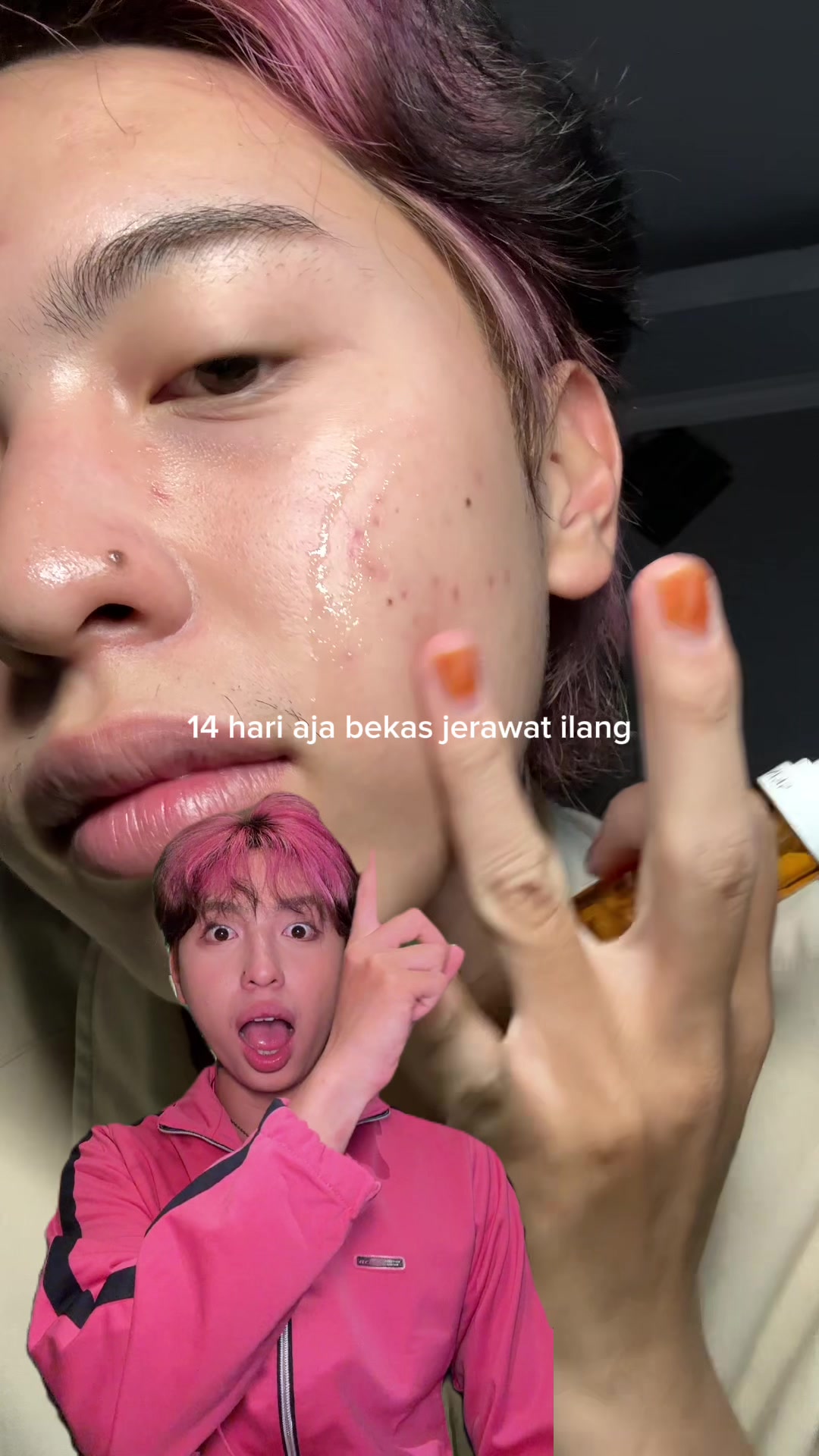 @Qin