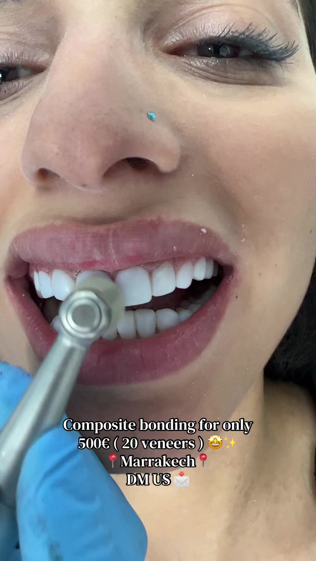 @Smilesecret