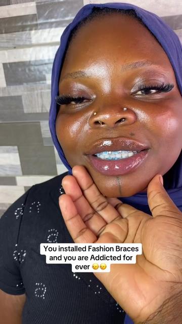 @Braces.bymavi|Smile Aesthetics