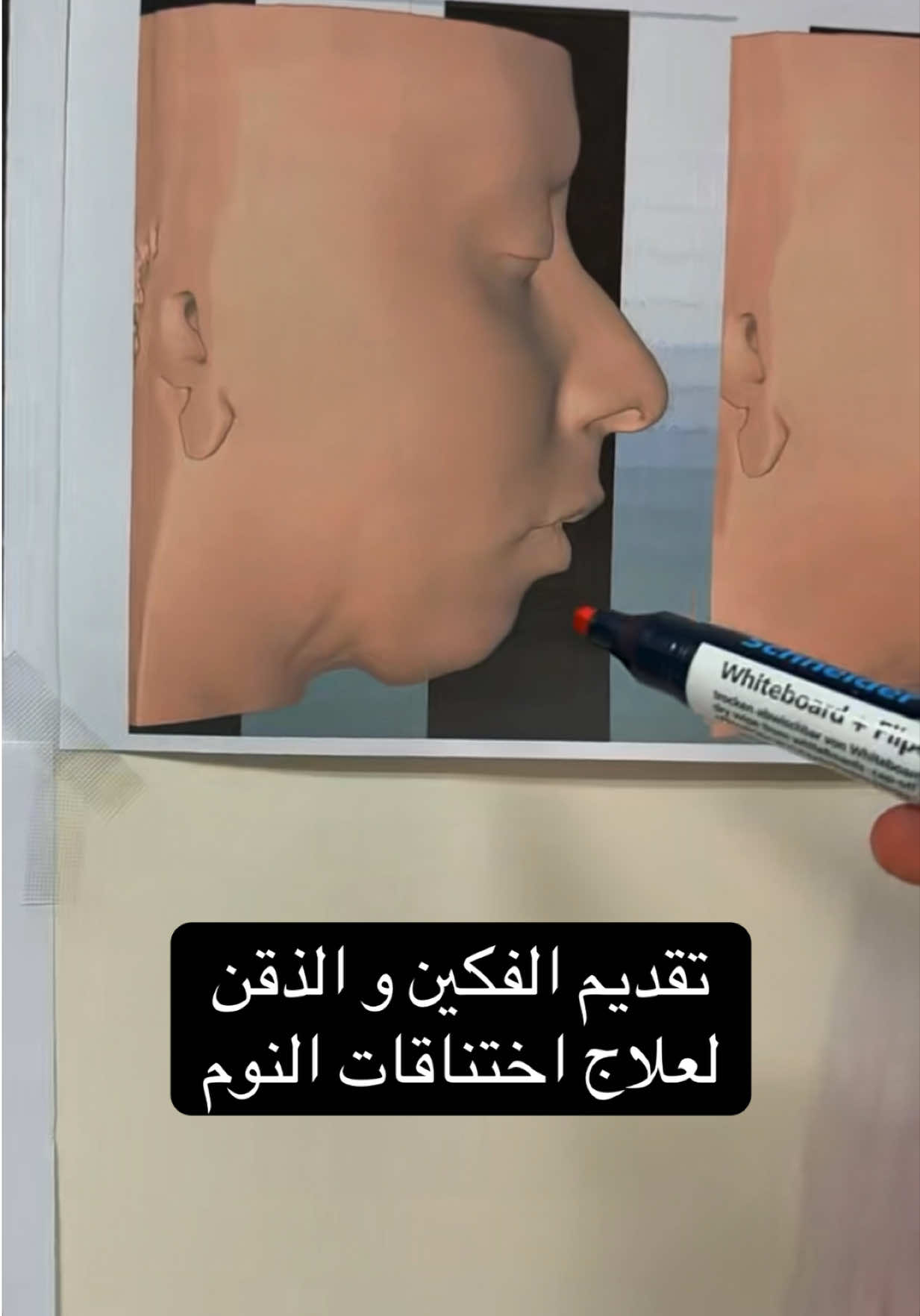 @Dr.Faleh Ali Alshahrani