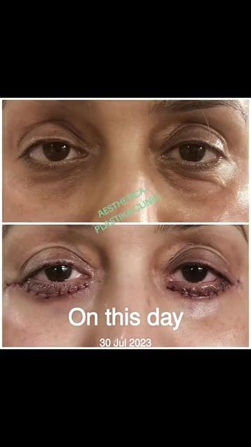 @Dr Firdous Khan PlasticSurgeon