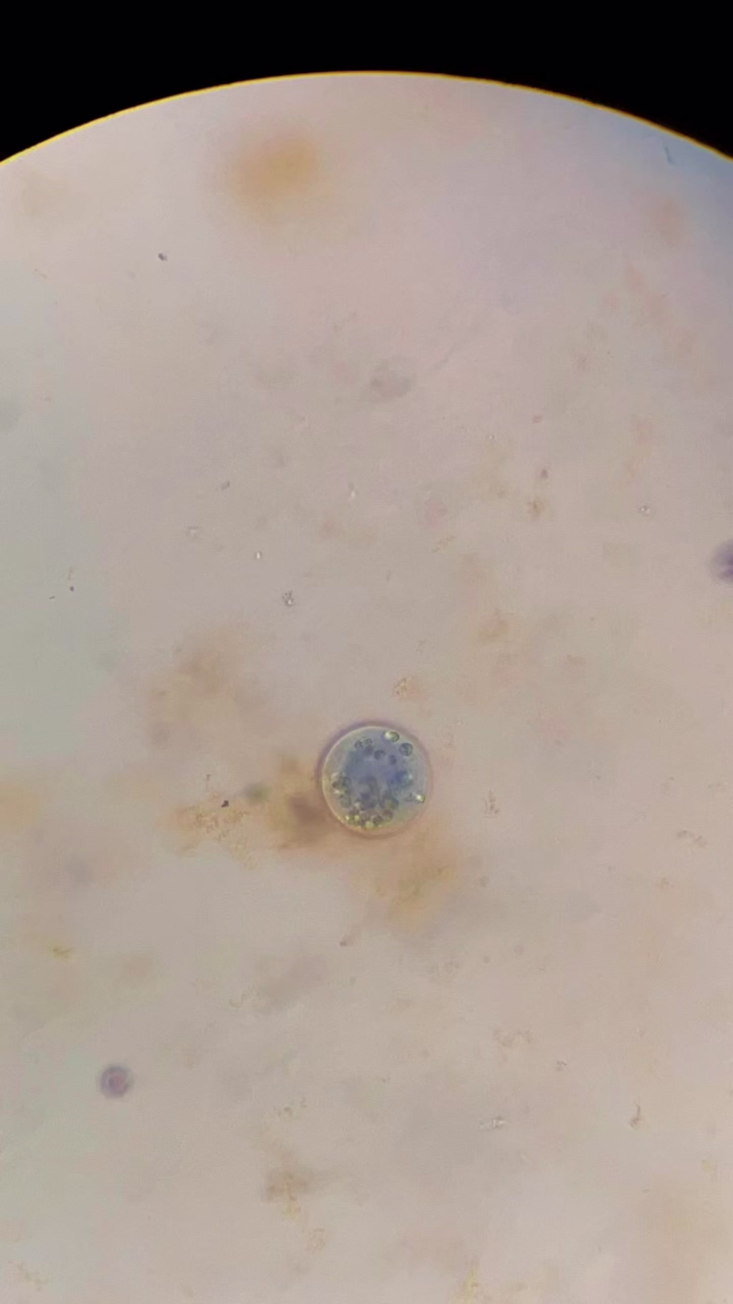 @ALab 🔬💉🩸