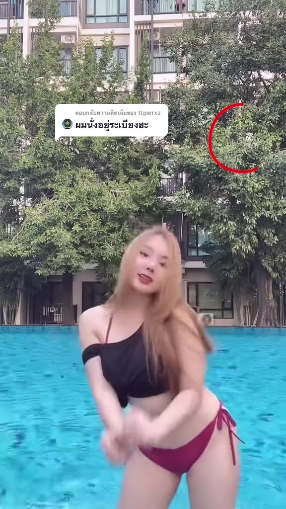 @บอมเบไม่เคยผ่าตัดไส้ติ่ง