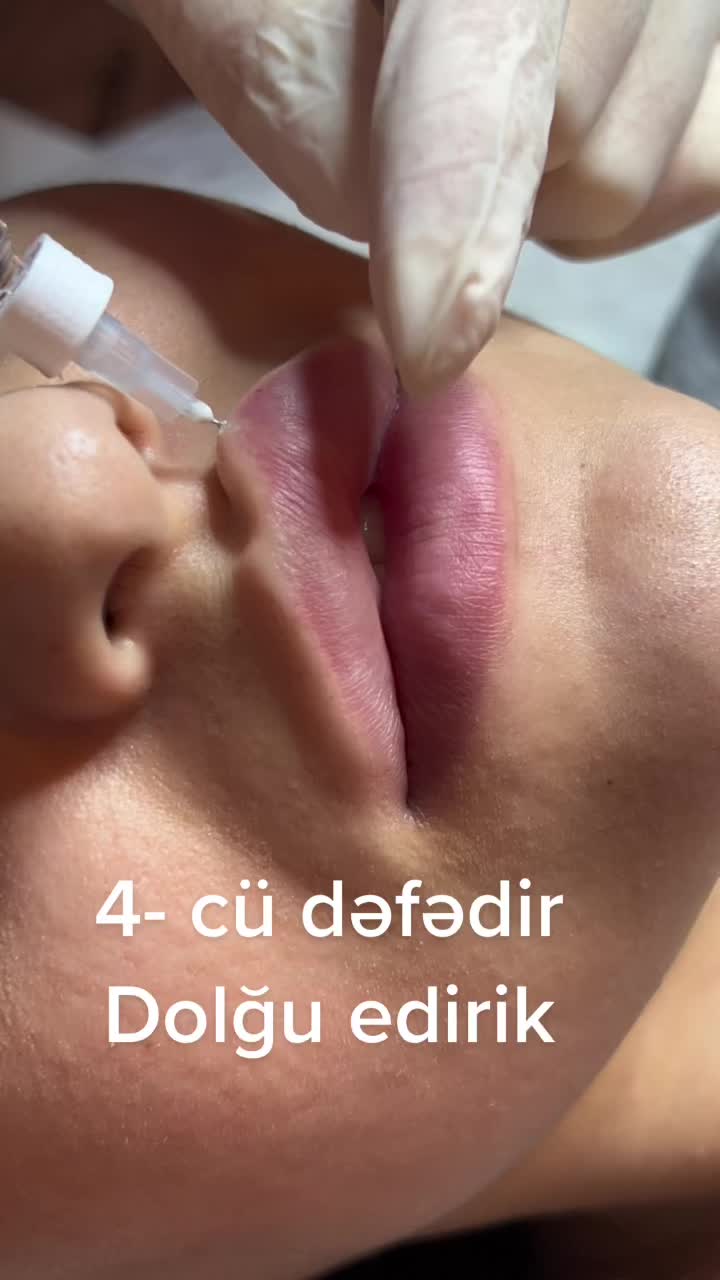 @Dr.kemale.nazarli Dermatoloq