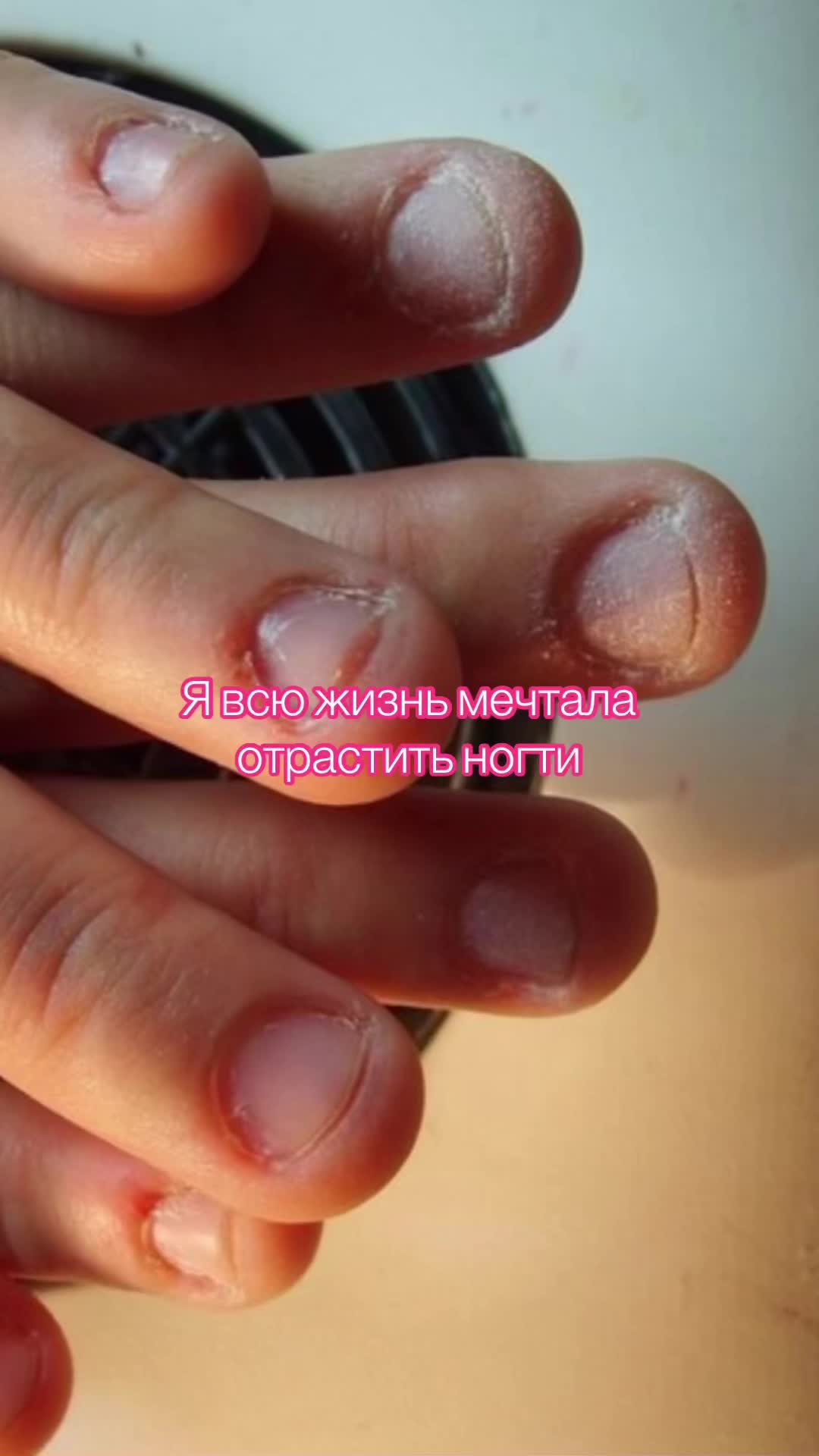 @Ari🥰